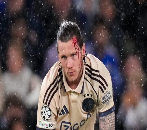 韦格霍斯特在与切尔西的比赛中额头被踢破，血流了一脸