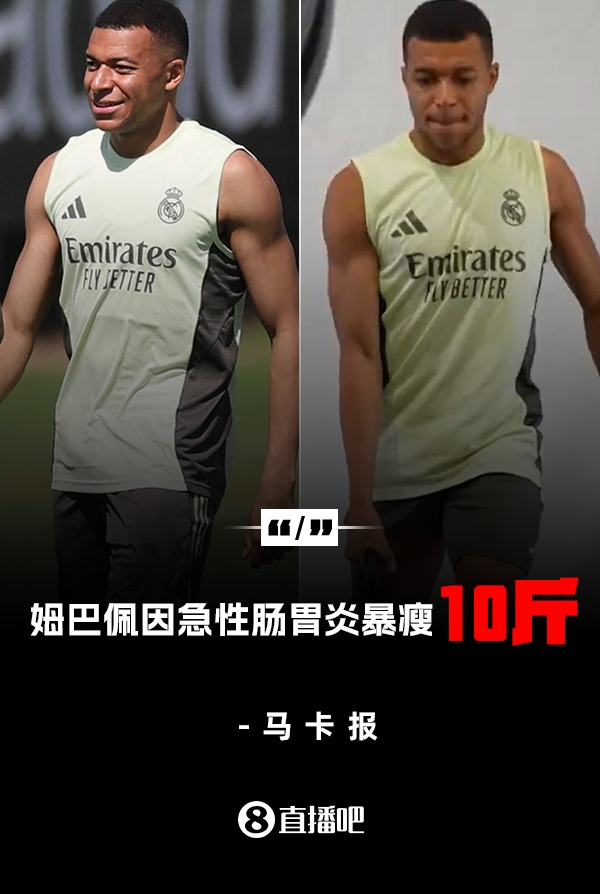 暴瘦10斤马卡:姆巴佩经历肠胃炎煎熬后,体重下降了45公斤