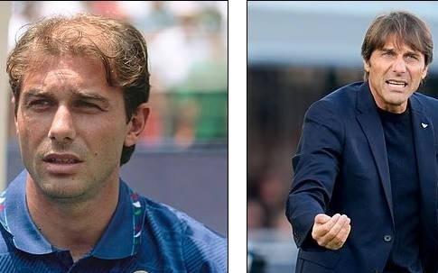 官方：热刺与土耳其植发诊所Elithair