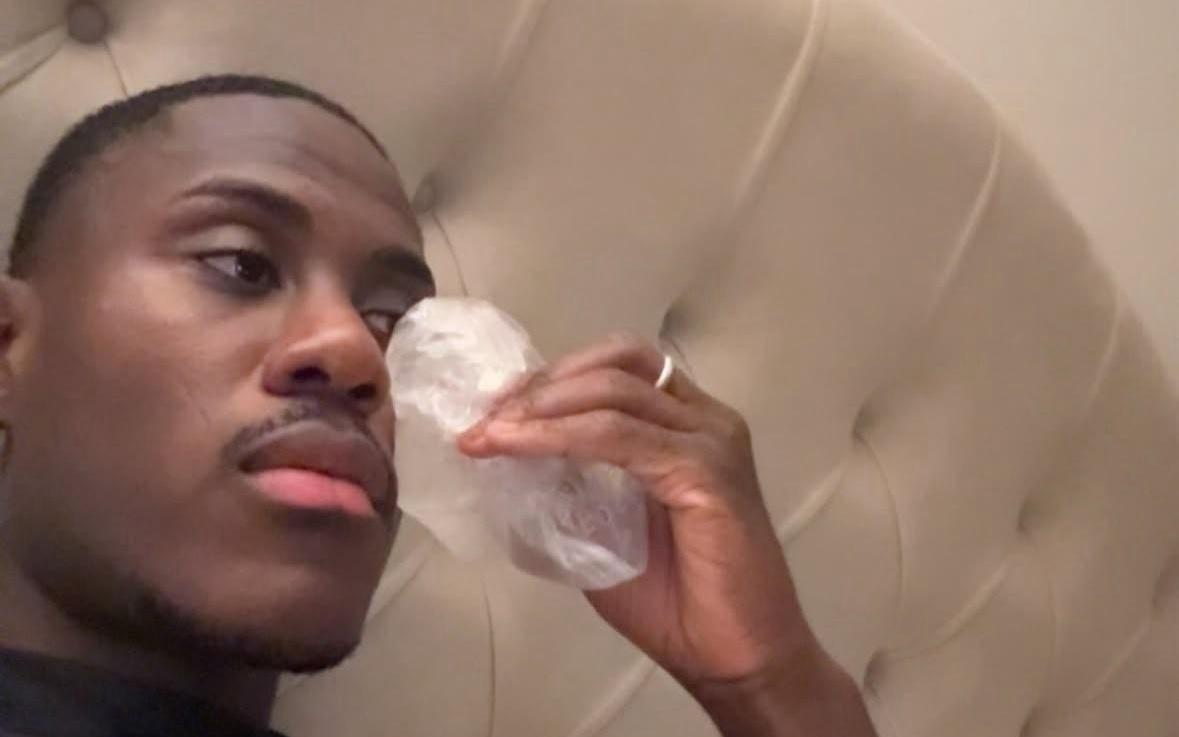 被因卡皮耶的肘部撞到，查洛巴赛后晒