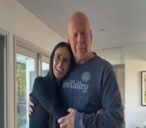 额颞叶痴呆症日益严重布鲁斯威利斯死后将捐出大脑用于医学研究