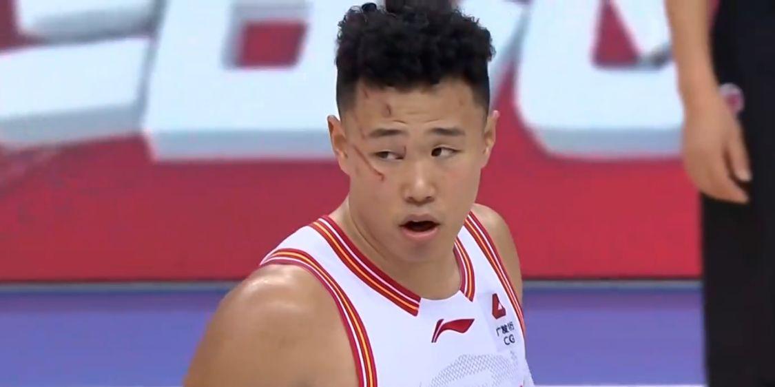 CBA强度这么大国手后卫遭九阴白骨爪袭击，面部血痕累累不犯规