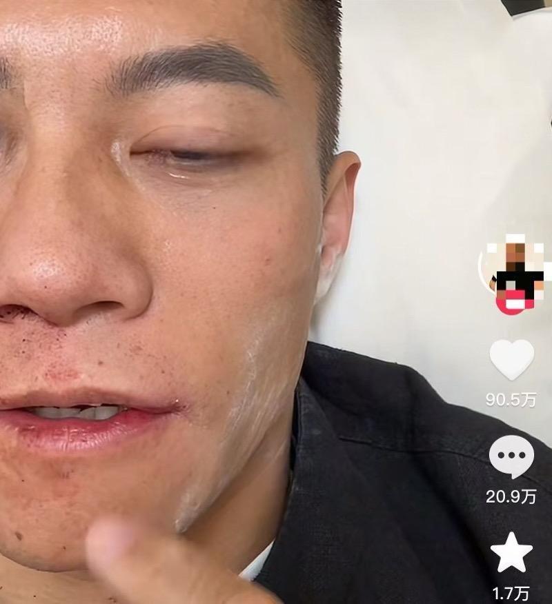 扇耳光大赛倒地的中国选手再谈失利：不后悔上场，坚定了决心